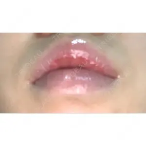 B-LINE CLINIC B-LINE CLINIC 池袋院口コミ