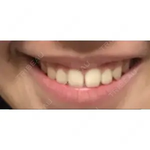 口コミ