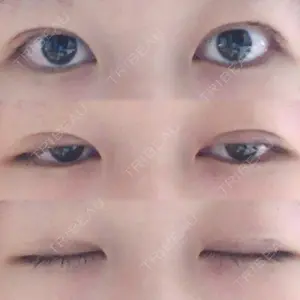 湘南美容クリニック 湘南美容クリニック 東京蒲田院口コミ