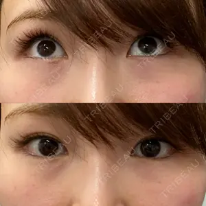 口コミ