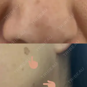 アスク美容クリニック銀座口コミ