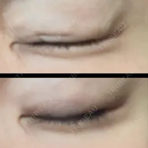 口コミ