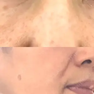 アスク美容クリニック銀座口コミ