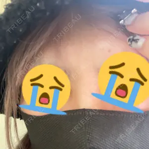 TCB東京中央美容外科 TCB東京中央美容外科 千葉駅前院口コミ