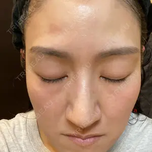 プラチナクリニック口コミ