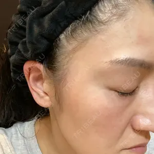 プラチナクリニック口コミ