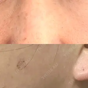 アスク美容クリニック銀座口コミ