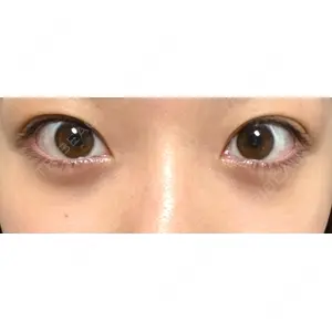APOLLO BEAUTY CLINIC口コミ
