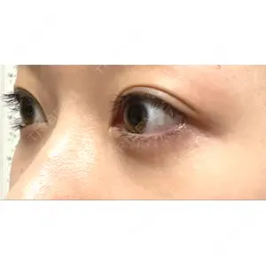 APOLLO BEAUTY CLINIC口コミ