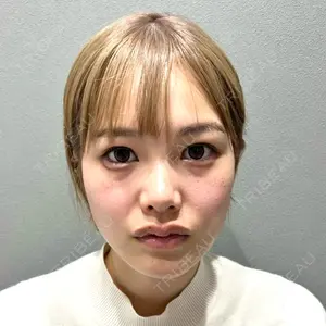 YBC横浜美容外科 YBC横浜美容外科 大宮院口コミ