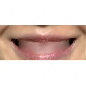 B-LINE CLINIC B-LINE CLINIC 池袋院口コミ