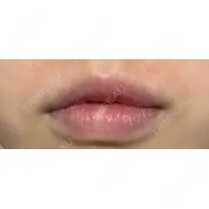 B-LINE CLINIC B-LINE CLINIC 池袋院口コミ