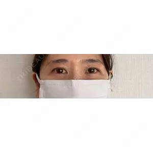 セオリークリニック口コミ