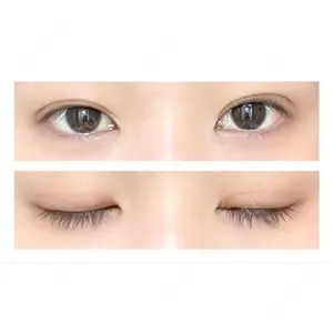 東京BELLEZZAクリニック口コミ