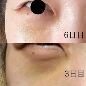 APOLLO BEAUTY CLINIC口コミ