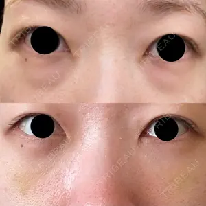 APOLLO BEAUTY CLINIC口コミ