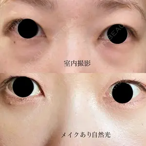 APOLLO BEAUTY CLINIC口コミ