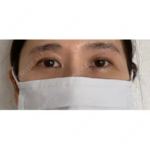 セオリークリニック口コミ
