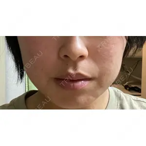 TCB東京中央美容外科 TCB東京中央美容外科 浜松院口コミ