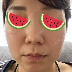 まゆりなclinic 名古屋栄口コミ