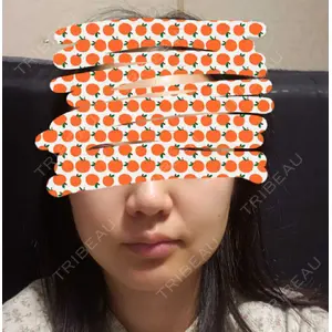 TCB東京中央美容外科 TCB東京中央美容外科 自由が丘院口コミ