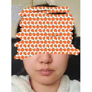 TCB東京中央美容外科 TCB東京中央美容外科 自由が丘院口コミ