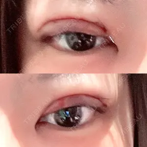 口コミ