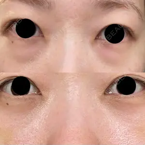 APOLLO BEAUTY CLINIC口コミ