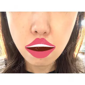 口コミ