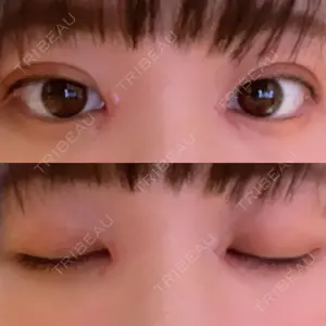 AI Beauty Clinic （エーアイ美容クリニック）口コミ