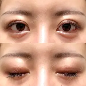 ルネッサンス美容外科医院 ルネッサンス美容外科医院 青山本院口コミ