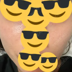 東京エビスクリニック口コミ