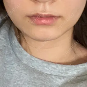 口コミ
