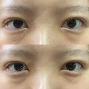湘南美容クリニック 湘南美容クリニック 新宿本院口コミ