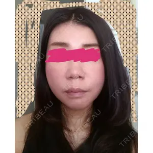 有楽町高野美容クリニック口コミ