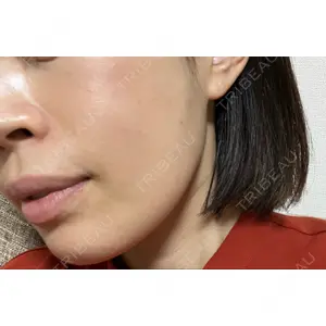 X CLINIC X CLINIC 銀座院口コミ