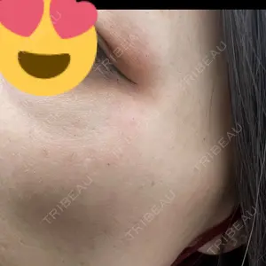 TCB東京中央美容外科 TCB東京中央美容外科 郡山院口コミ