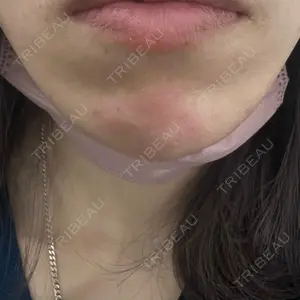 TCB東京中央美容外科 TCB東京中央美容外科 郡山院口コミ