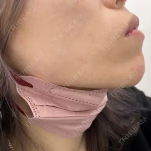 TCB東京中央美容外科 TCB東京中央美容外科 郡山院口コミ