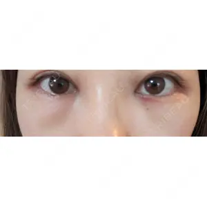 HAAB×DREAM BEAUTY CLINIC HAAB×DREAM BEAUTY CLINIC 大阪梅田院口コミ