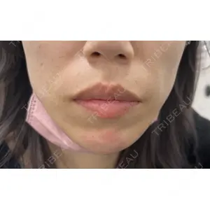 TCB東京中央美容外科 TCB東京中央美容外科 郡山院口コミ