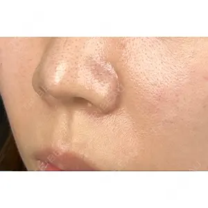 藤・ナチュレ美容クリニック 藤・ナチュレ美容クリニック 恵比寿院口コミ