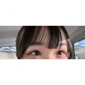 グローバルビューティークリニック 東京院の