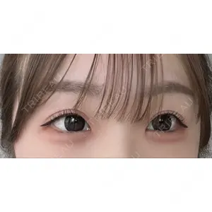 グローバルビューティークリニック 東京院の