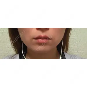 TCB東京中央美容外科 TCB東京中央美容外科 高田馬場院口コミ