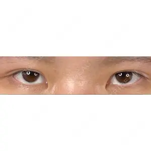 藤・ナチュレ美容クリニック 藤・ナチュレ美容クリニック 恵比寿院口コミ
