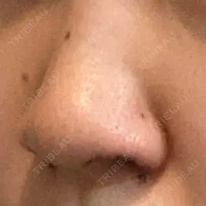 GLANZ CLINIC口コミ