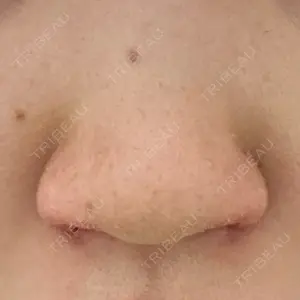 GLANZ CLINIC口コミ