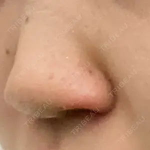 GLANZ CLINIC口コミ