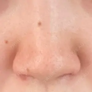 GLANZ CLINIC口コミ